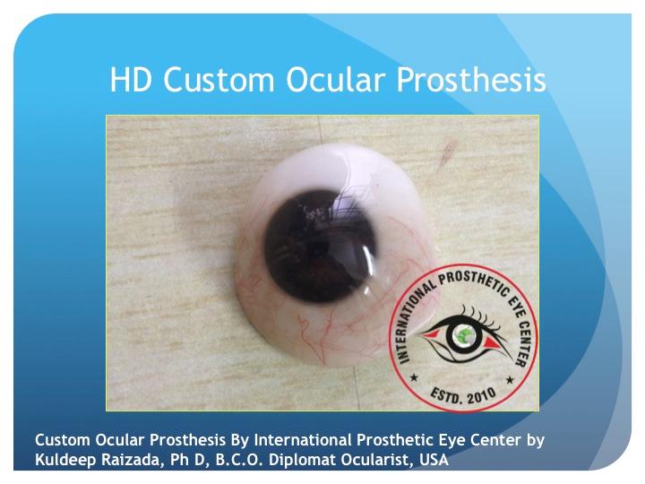 Custom Artificial Eyes India : Kuldeep Raizada, Ph D, BCO 