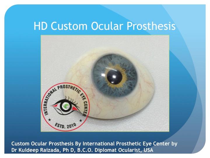 Custom Artificial Eyes India : Kuldeep Raizada, Ph D, BCO 