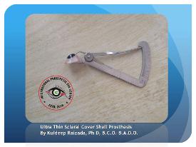 Ultra Thin Scleral Cover Shell Prosthesis