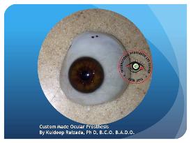 Custom Made Artificial Eye India