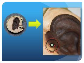 Silicone Life Like Ear Prosthesis