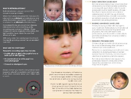 Retinoblastoma India